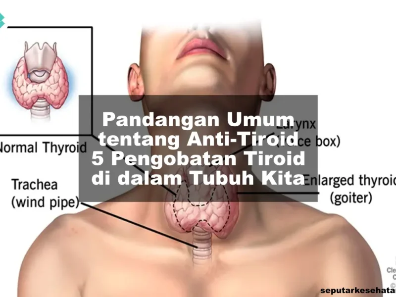 Pandangan Umum tentang Anti-Tiroid - 5 Pengobatan Tiroid di dalam Tubuh Kita