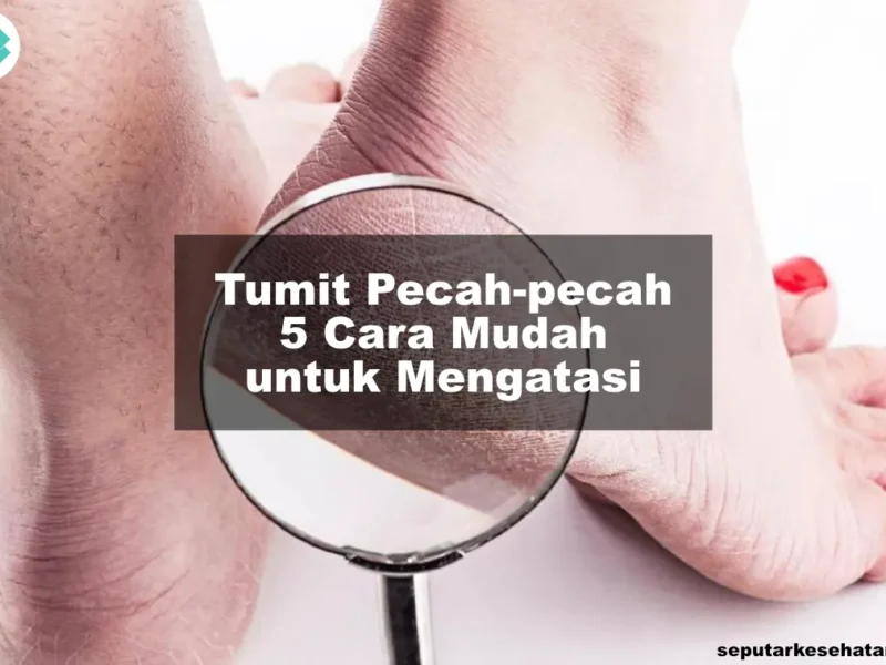 Tumit Pecah-pecah 5 Cara Mudah untuk Mengatasi