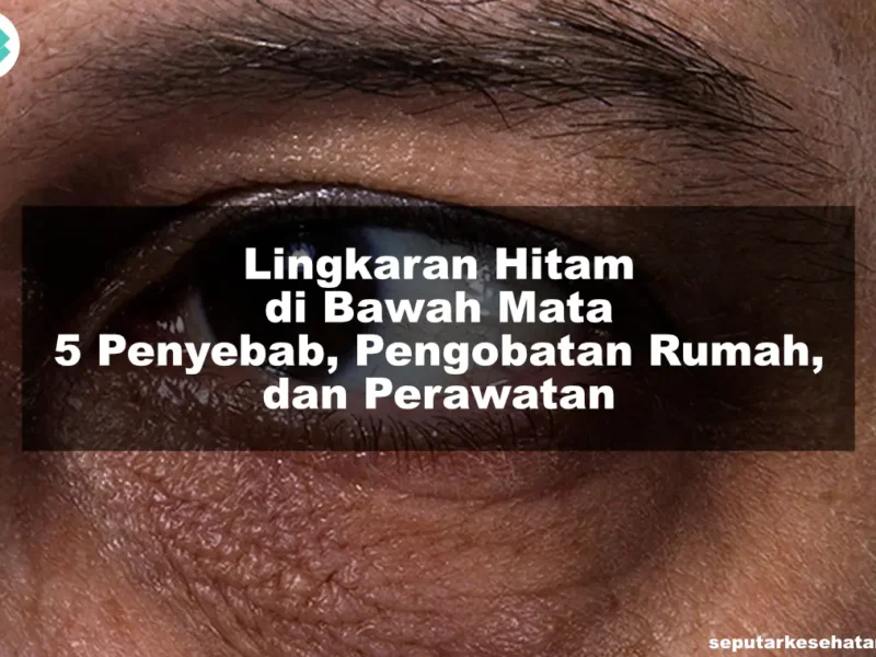 Lingkaran Hitam di Bawah Mata 5 Penyebab, Pengobatan Rumah, dan Perawatan
