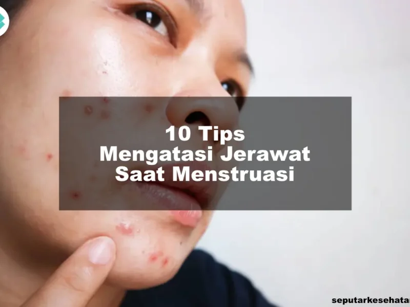 10 Tips Mengatasi Jerawat Saat Menstruasi