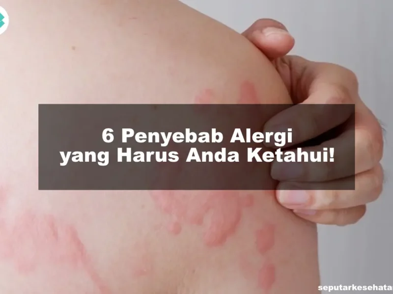 6 Penyebab Alergi yang Harus Anda Ketahui!